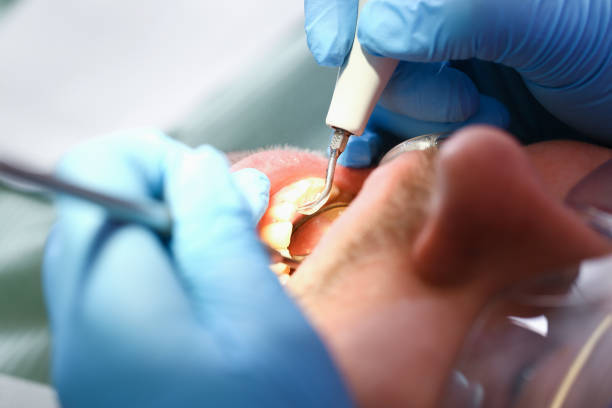 Best Emergency Dental Surgery in Keene, NH