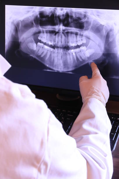 Best Emergency Tooth Extraction in Keene, NH